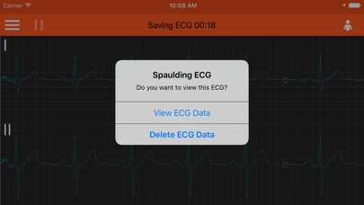 Screenshot #2 pour Spaulding ECG