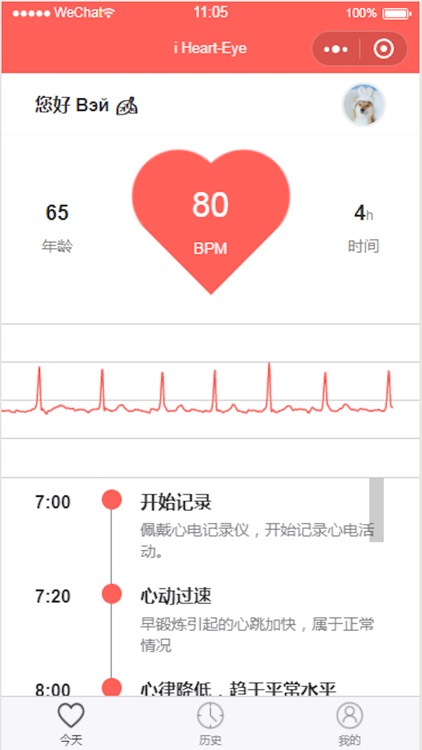 爱心眼