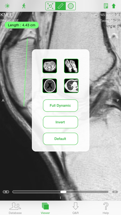 OsiriX HD Screenshot