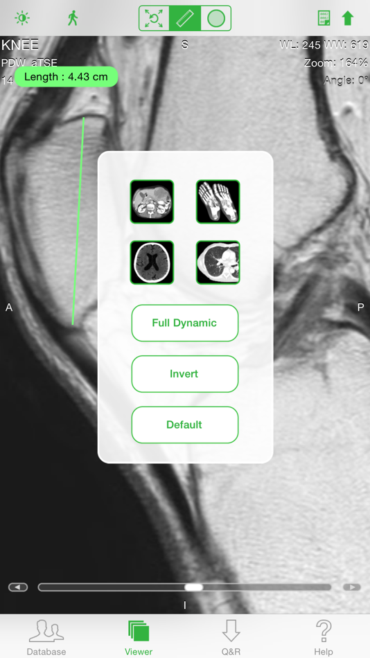 #3. OsiriX HD (iOS) 由: Pixmeo SARL