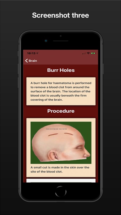 NeuroSurgery SP screenshot-3