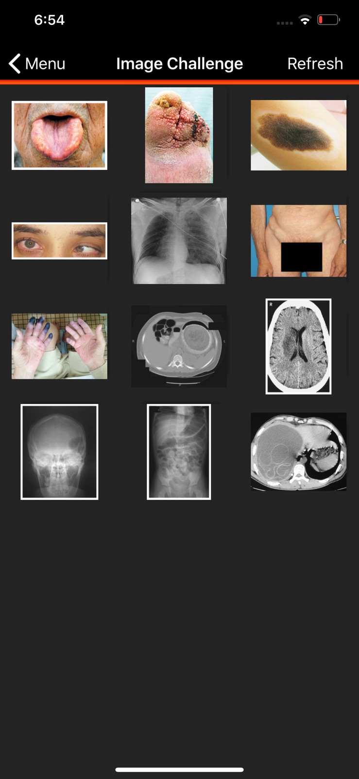 NEJM Image Challenge iphone screenshot 3