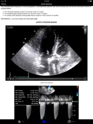 echosource ipad resimleri 1
