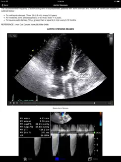 EchoSource iPad image 1