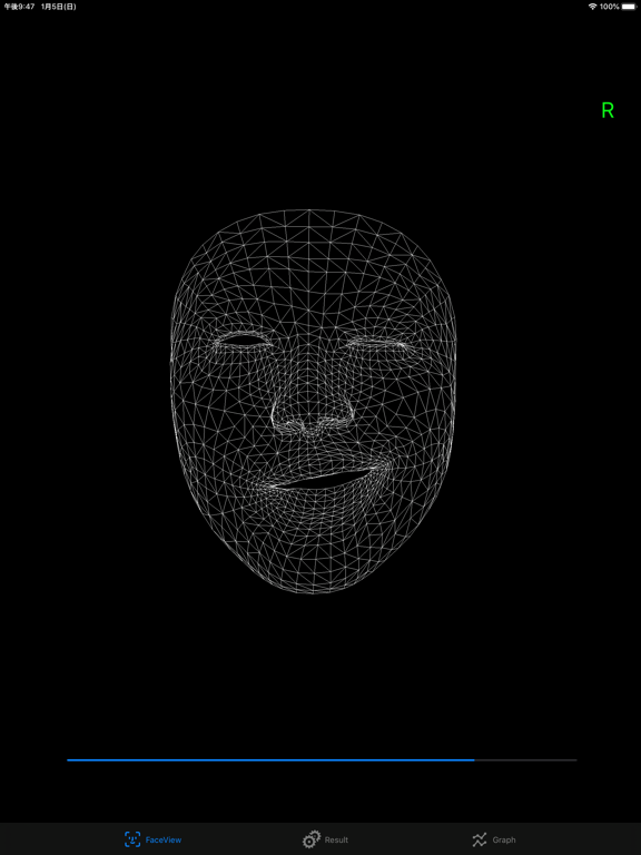 Screenshot #4 pour FacialPalsyZero