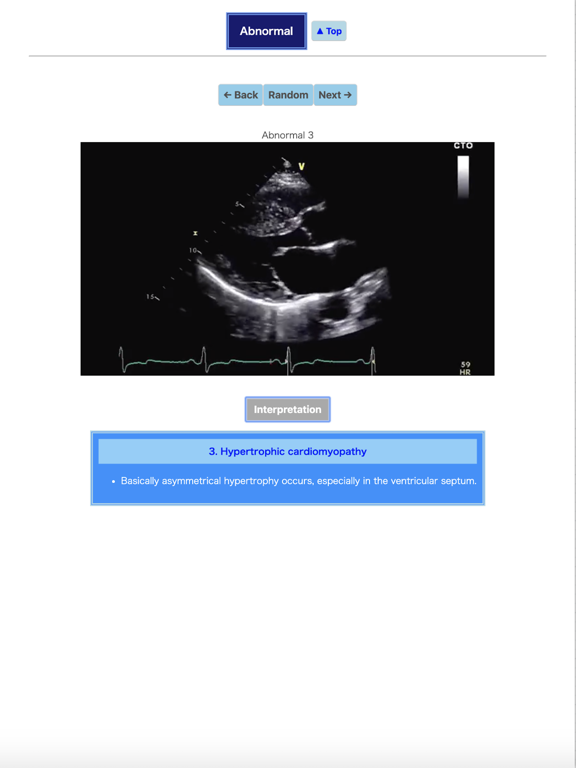 Screenshot #6 pour Pocket Heart Echo