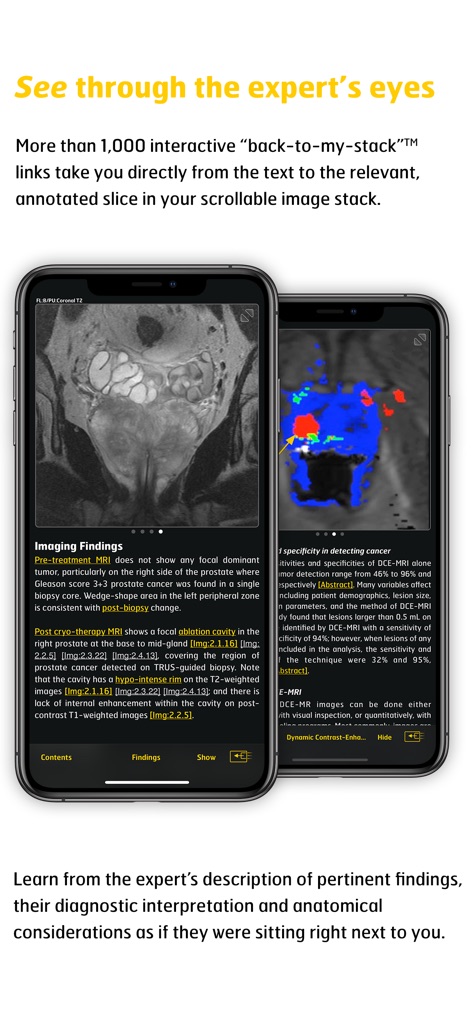 MR Imaging in Prostate Cancer - Medical App | MWM