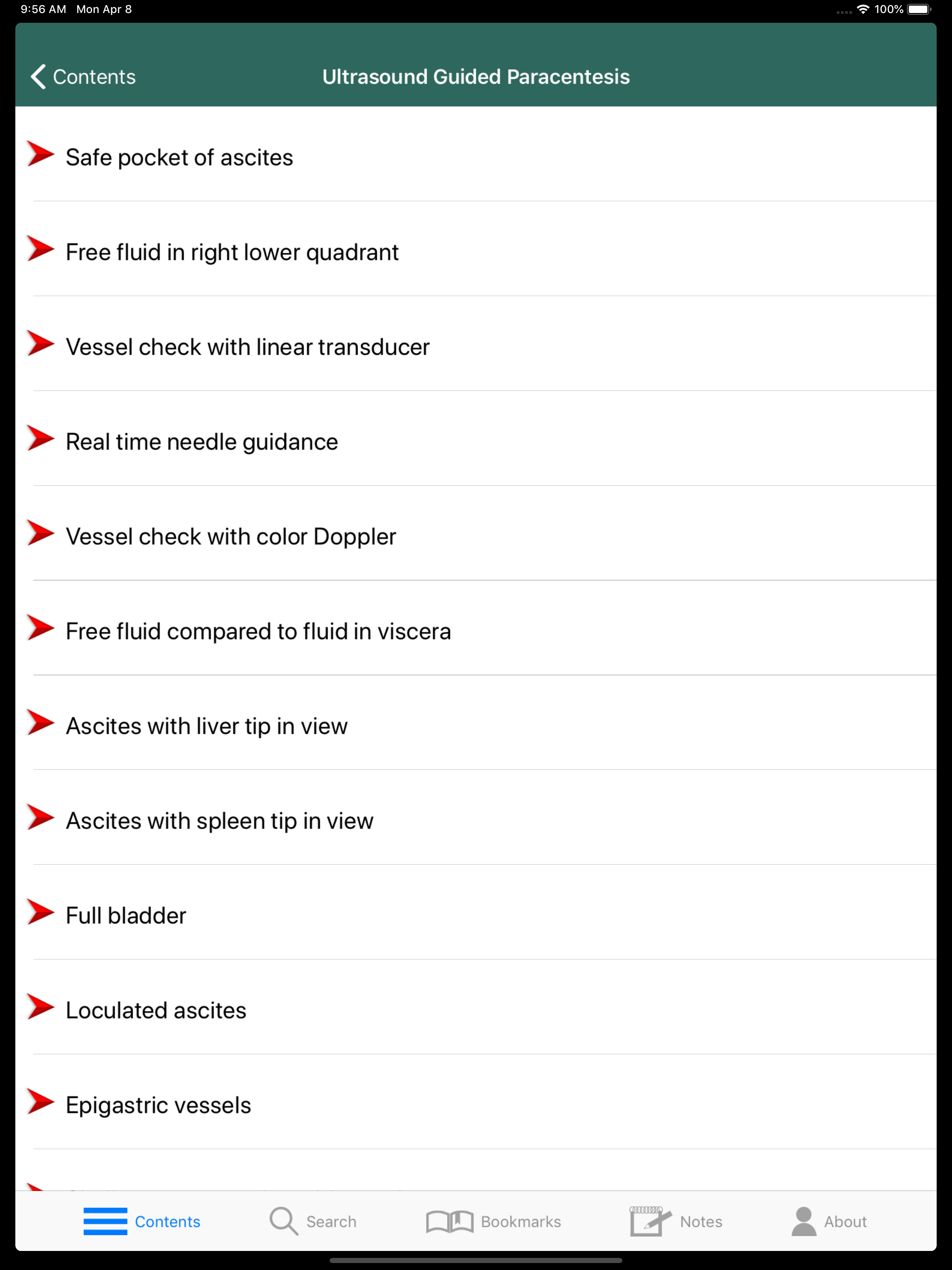 Videos for POCUS: Ultrasound screenshot 8