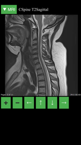 MRI Viewer screenshot