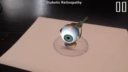 Game screenshot Diabetic Retinopathy AR apk