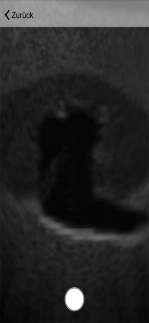 Ultraschall(圖4)-速報App