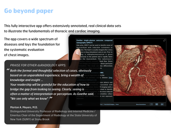 Thoracic Imaging Fundamentals iPad app afbeelding 2