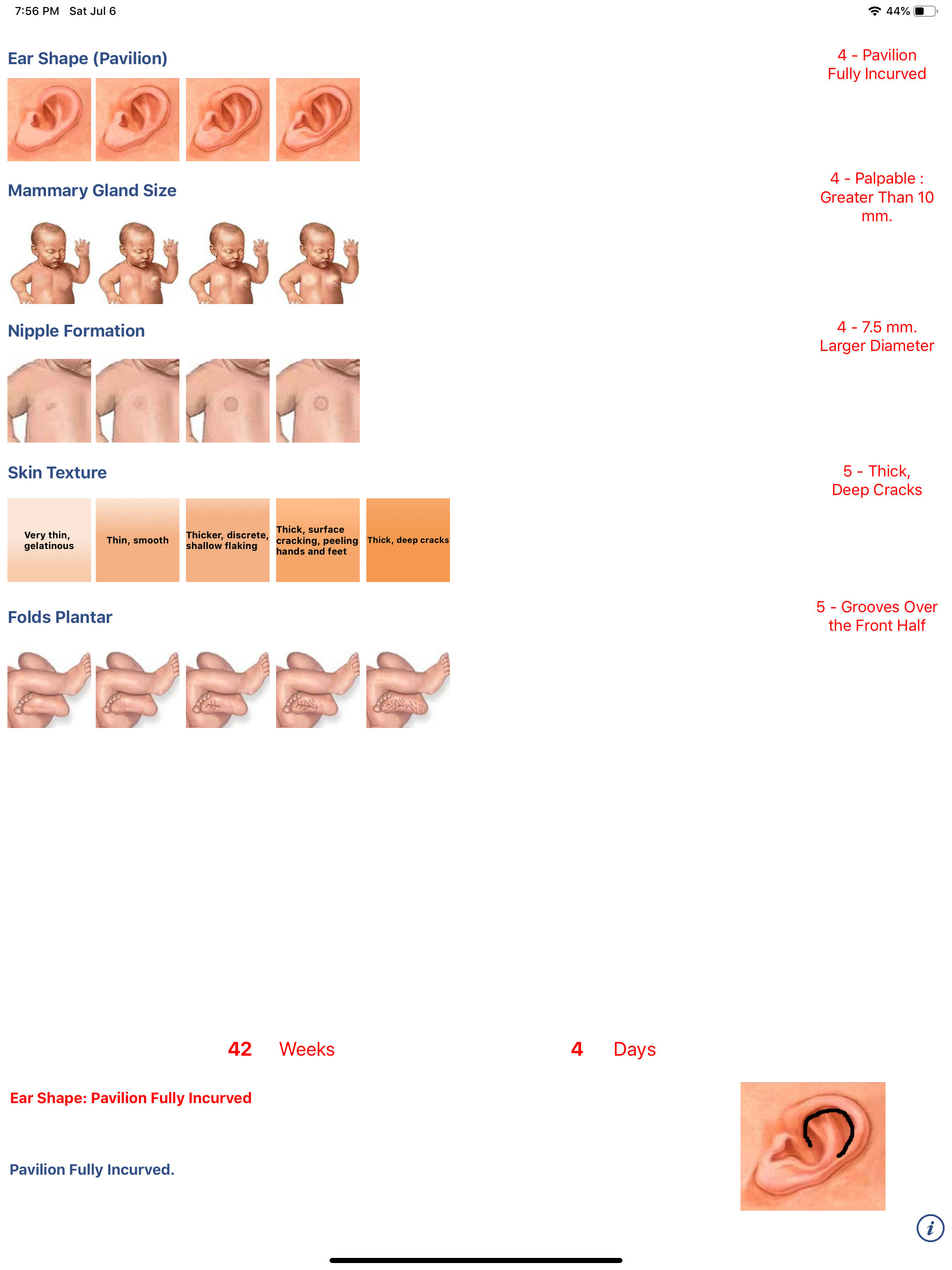 Neonatology: Test Capurro screenshot 6