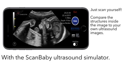 ScanBaby learn baby ultrasound Screenshot