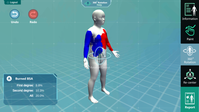 3D PED Burn Resuscitation Screenshot