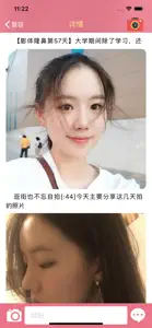 北京整形美容圈-微整形美容交流分享 screenshot #1 for iPhone