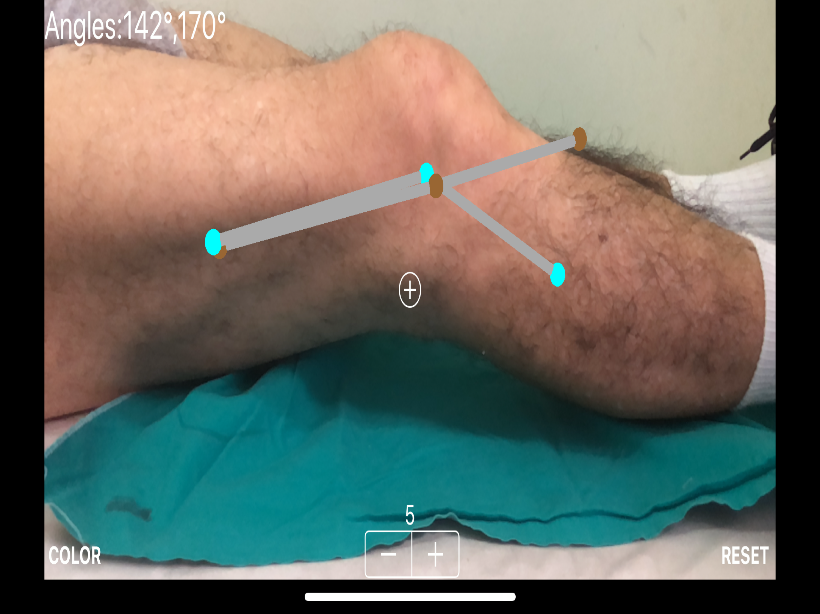 ARorthopaedicGoniometer screenshot 13