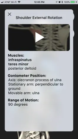 Game screenshot OT Kinesiology Pro Consult hack