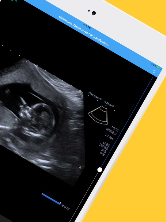 Screenshot #6 pour FSR Patient