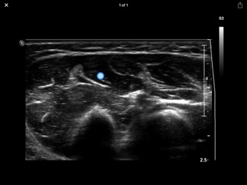 Muscle Ultrasound Course iPad screenshot