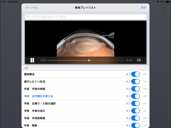 iCeye 白内障のおすすめ画像3