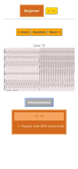 Game screenshot Pocket ECG hack