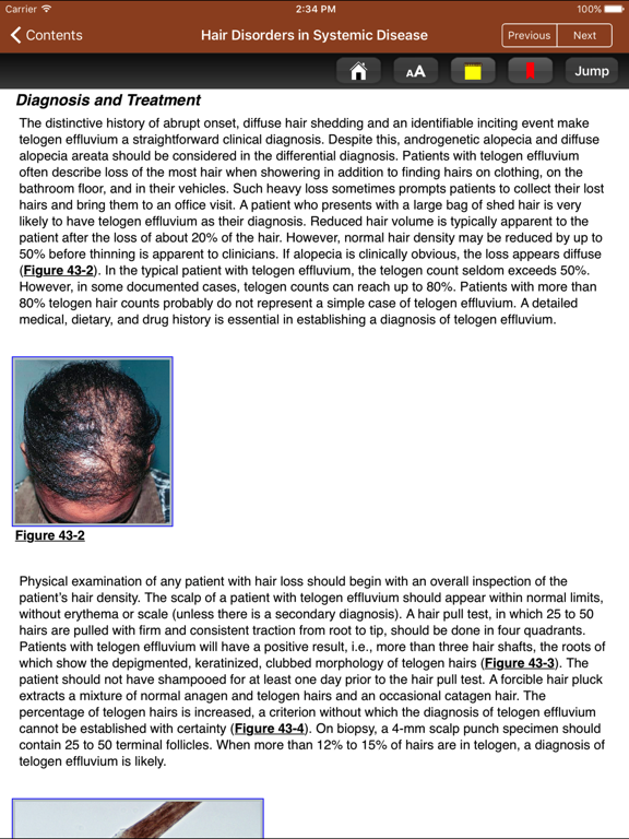 Screenshot #6 pour Derm Signs Systemic Disease 5E