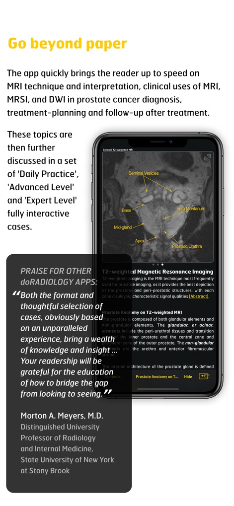 MR Imaging in Prostate Cancer - Medical App | MWM