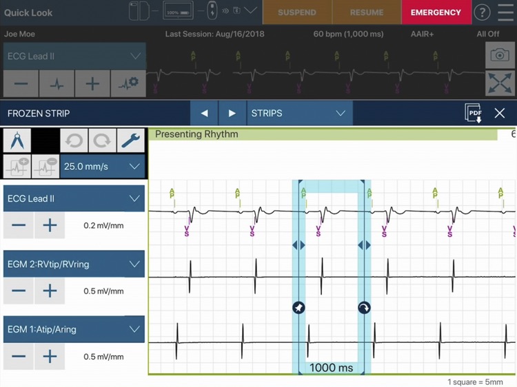 CareLink SmartSync™ SEAR screenshot-4