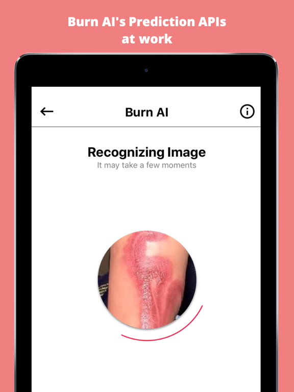 Screenshot #5 pour Burn AI