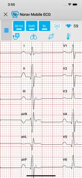 Game screenshot Norav Medical Mobile ECG hack