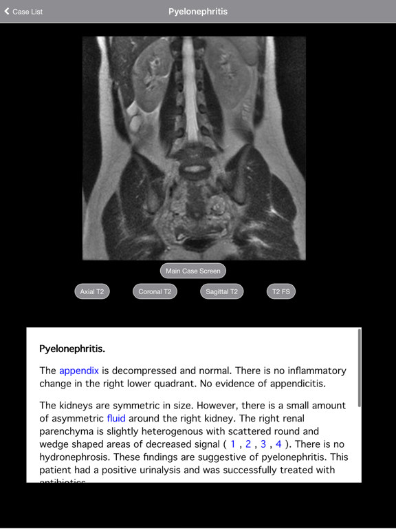 Pregnant Appendicitis iPad screenshot 5 - Medical app