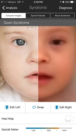 Face2Gene screenshot 1