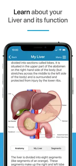 Game screenshot My Liver apk