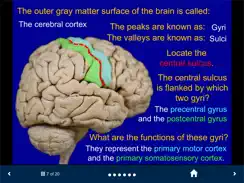 Neuroanatomy - SecondLook iPad image 2