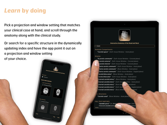 Radiology - Head&Neck Anatomy iPad screenshot 4 - Medical app