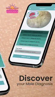 mole checker skin dermatology iphone screenshot 2