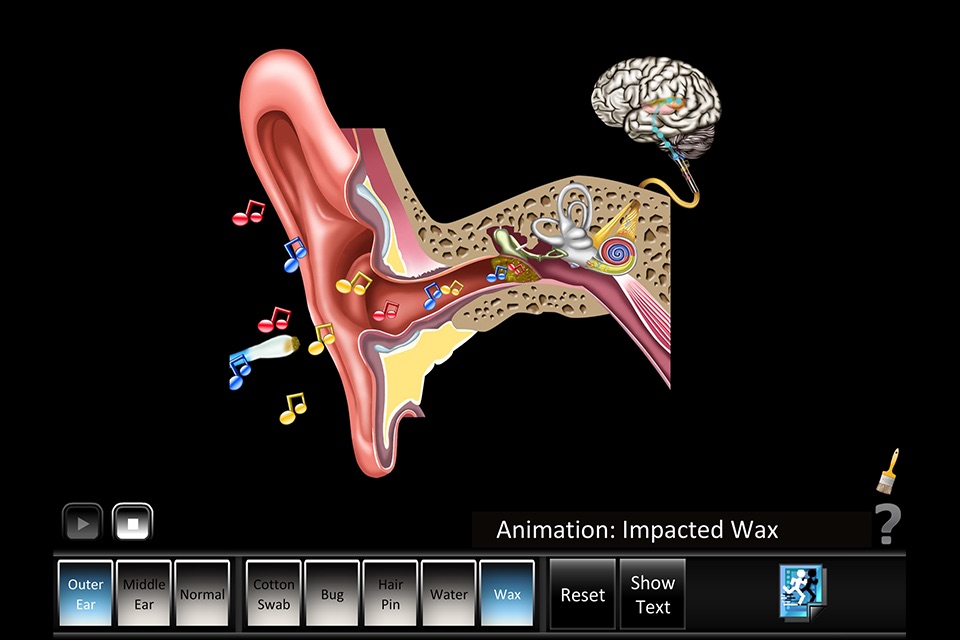 Ear Disorders: Outer Middle screenshot 4