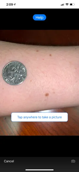 Game screenshot Mole Mapper Melanoma Study hack