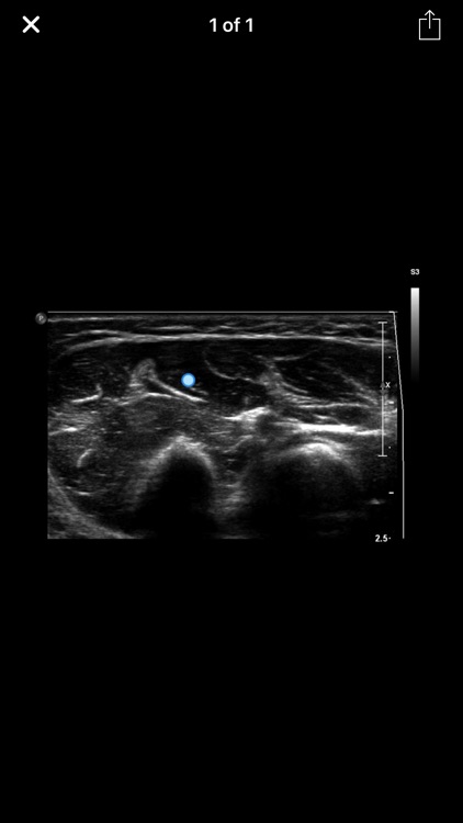 Muscle Ultrasound Course screenshot-3