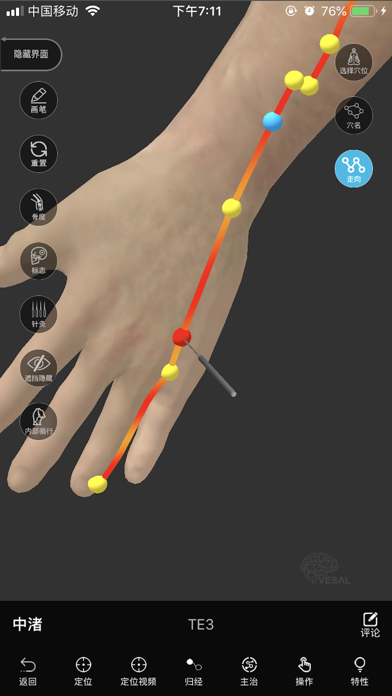 Acupuncture Master screenshot 2