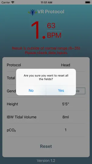 LF Ventilator Protocol iPhone Screenshot 4