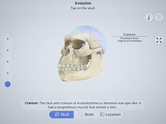 Brainapse iPad app afbeelding 1