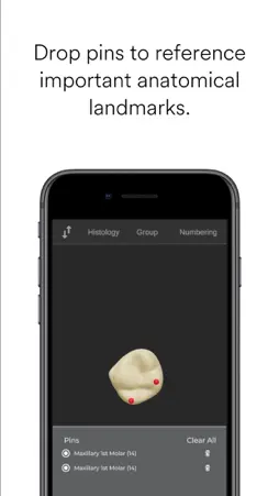 ToothView™ screenshot 4
