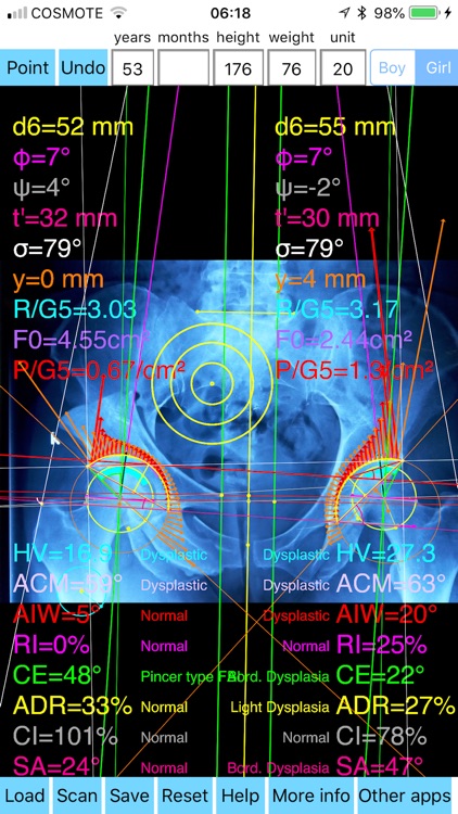 HipDysplasiaPro screenshot-6