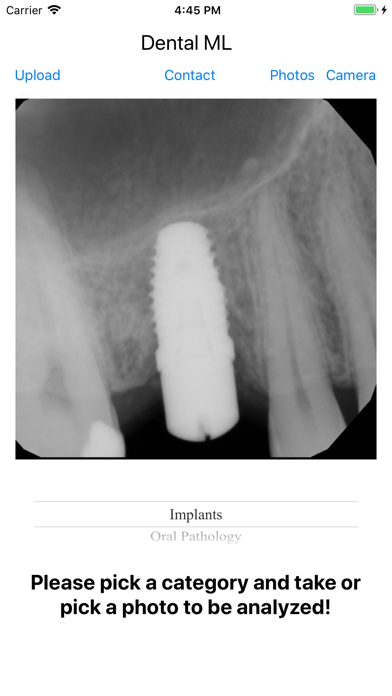 Dental ML screenshot 2