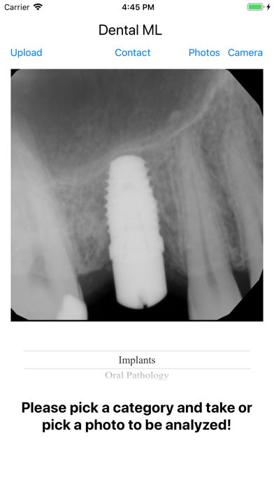 Dental ML Screenshot