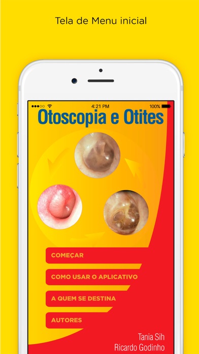 Screenshot #1 pour Otoscopia e Otites RA