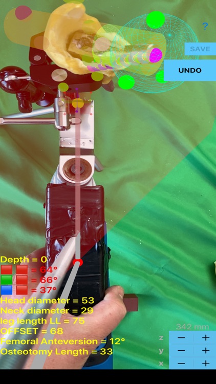 FemurOsteotomyTHR screenshot-9