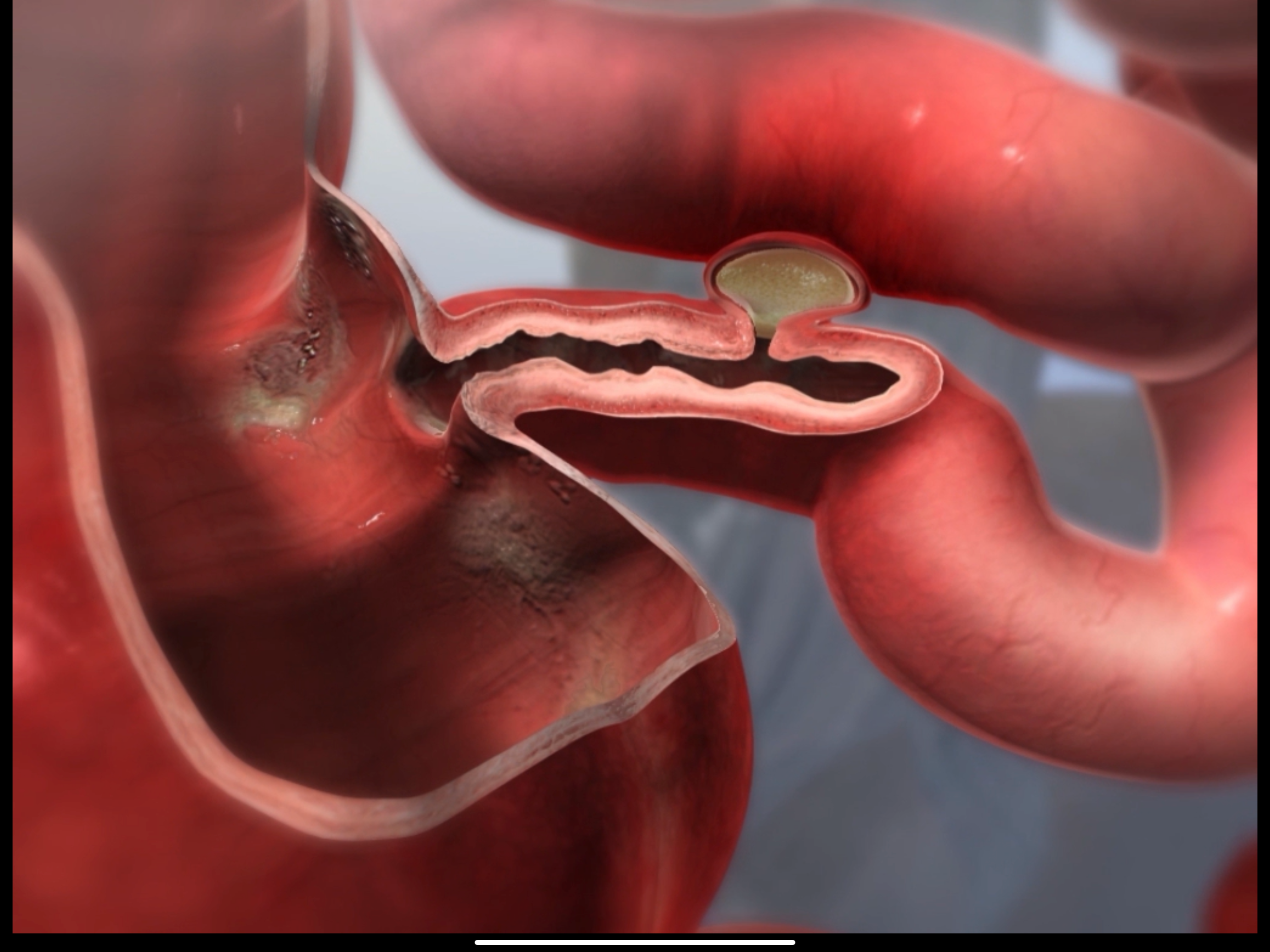 Physiology & Pathology